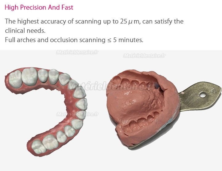 Scanner intraoral numérique dentaire 3D Fussen